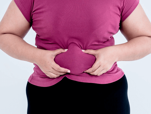 Weight Loss Surgery